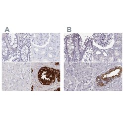 Invitrogen SEMG2 Polyclonal Antibody 100 &mu;L; Unconjugated:Antibodies,