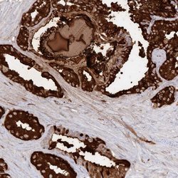 Invitrogen SEMG2 Polyclonal Antibody 100 &mu;L; Unconjugated:Antibodies,