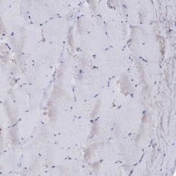 Invitrogen SEMG2 Polyclonal Antibody 100 &mu;L; Unconjugated:Antibodies,