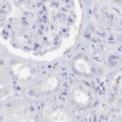 Invitrogen SEMG2 Polyclonal Antibody 100 &mu;L; Unconjugated:Antibodies,