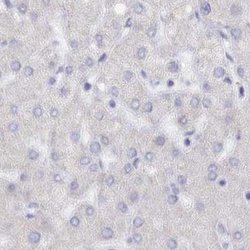 Invitrogen SEMG2 Polyclonal Antibody 100 &mu;L; Unconjugated:Antibodies,