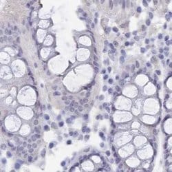 Invitrogen SEMG2 Polyclonal Antibody 100 &mu;L; Unconjugated:Antibodies,