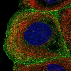Invitrogen ARHGAP40 Polyclonal Antibody 100 &mu;L; Unconjugated:Antibodies,