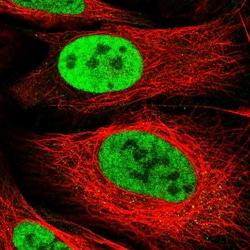 Invitrogen ARS2 Polyclonal Antibody 100 &mu;L; Unconjugated:Antibodies,