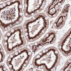 Invitrogen ARS2 Polyclonal Antibody 100 &mu;L; Unconjugated:Antibodies,