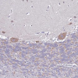 Invitrogen RC3H2 Polyclonal Antibody 100 &mu;L; Unconjugated:Antibodies,