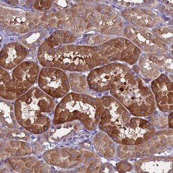 Invitrogen RC3H2 Polyclonal Antibody 100 &mu;L; Unconjugated:Antibodies,
