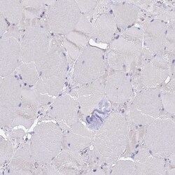 Invitrogen RC3H2 Polyclonal Antibody 100 &mu;L; Unconjugated:Antibodies,