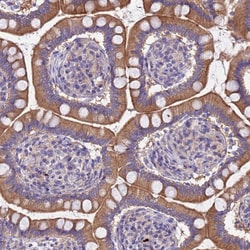 Invitrogen RC3H2 Polyclonal Antibody 100 &mu;L; Unconjugated:Antibodies,