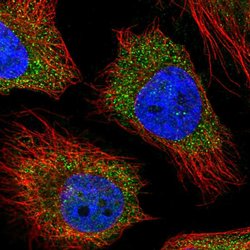 Invitrogen RC3H2 Polyclonal Antibody 100 &mu;L; Unconjugated:Antibodies,