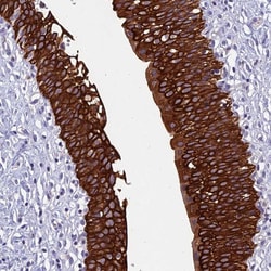 Invitrogen RBM41 Polyclonal Antibody 100 &mu;L; Unconjugated:Antikörper