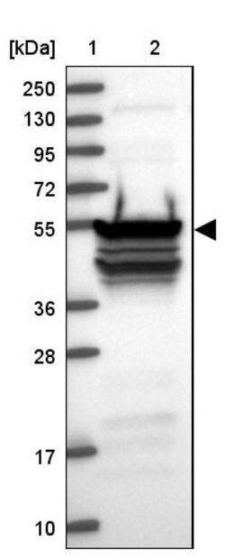 Invitrogen RBM41 Polyclonal Antibody 100 &mu;L; Unconjugated:Antibodies,