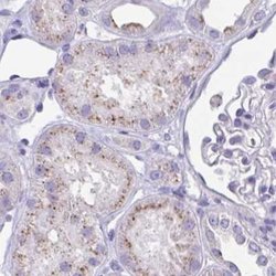 Invitrogen CHMP5 Polyclonal Antibody 100 &mu;L; Unconjugated:Antibodies,