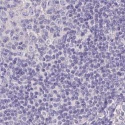 Invitrogen CHMP5 Polyclonal Antibody 100 &mu;L; Unconjugated:Antibodies,