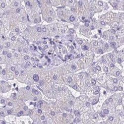 Invitrogen CHMP5 Polyclonal Antibody 100 &mu;L; Unconjugated:Antibodies,
