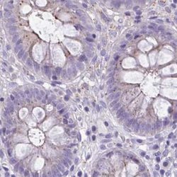 Invitrogen CHMP5 Polyclonal Antibody 100 &mu;L; Unconjugated:Antibodies,