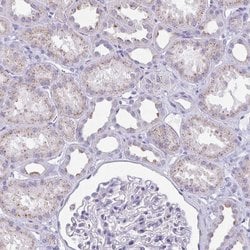 Invitrogen CHMP5 Polyclonal Antibody 100 &mu;L; Unconjugated:Antibodies,