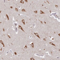 Invitrogen ABCA2 Polyclonal Antibody 100 &mu;L; Unconjugated:Antibodies,