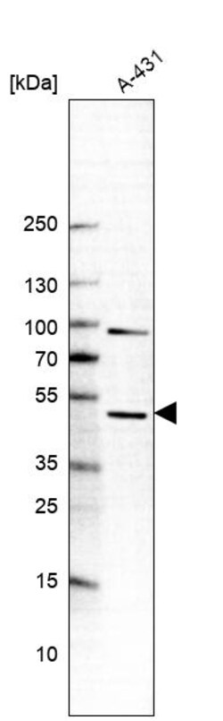 Invitrogen BSPRY Polyclonal Antibody 100 &mu;L | Buy Online | Invitrogen&trade; | Fisher Scientific
