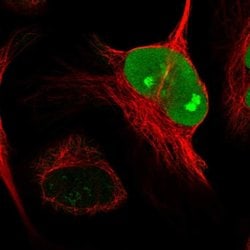 Invitrogen NUSAP1 Polyclonal Antibody 100 &mu;L; Unconjugated:Antibodies,