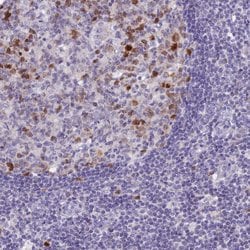 Invitrogen NUSAP1 Polyclonal Antibody 100 &mu;L; Unconjugated:Antibodies,