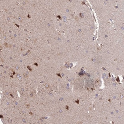 Invitrogen DTX2 Polyclonal Antibody 100 &mu;L; Unconjugated:Antibodies,