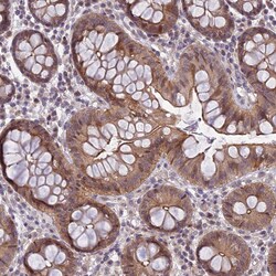 Invitrogen DTX2 Polyclonal Antibody 100 &mu;L; Unconjugated:Antibodies,