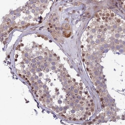 Invitrogen DTX2 Polyclonal Antibody 100 &mu;L; Unconjugated:Antibodies,