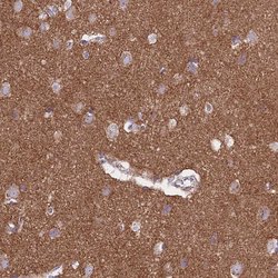 Invitrogen FRMPD1 Polyclonal Antibody 100 &mu;L; Unconjugated:Antibodies,