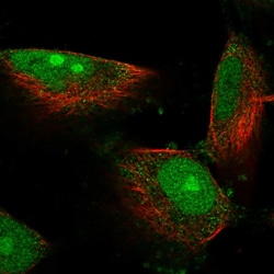 DIMT1 Polyclonal Antibody:Antibodies, Polyclonal