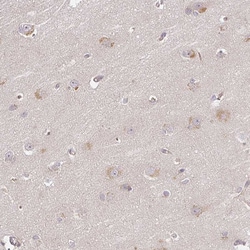 DIMT1 Polyclonal Antibody:Antibodies, Polyclonal