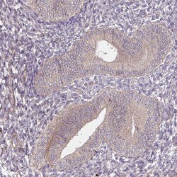 DIMT1 Polyclonal Antibody:Antibodies, Polyclonal