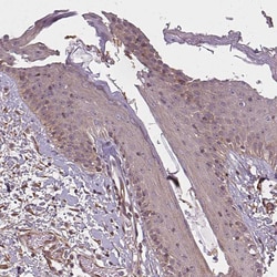 DIMT1 Polyclonal Antibody:Antibodies, Polyclonal