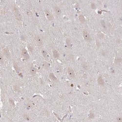 DIMT1 Polyclonal Antibody:Antibodies, Polyclonal