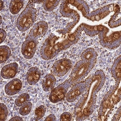 Invitrogen COQ4 Polyclonal Antibody 100 &mu;L; Unconjugated:Antibodies,
