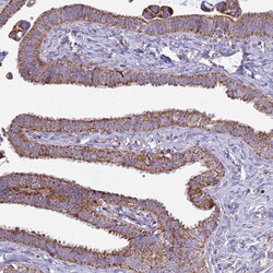 Invitrogen COQ4 Polyclonal Antibody 100 &mu;L; Unconjugated:Antibodies,