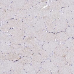Invitrogen COQ4 Polyclonal Antibody 100 &mu;L; Unconjugated:Antibodies,
