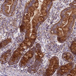 Invitrogen COQ4 Polyclonal Antibody 100 &mu;L; Unconjugated:Antibodies,
