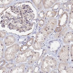 Invitrogen PAPD5 Polyclonal Antibody 100 &mu;L; Unconjugated:Antibodies,