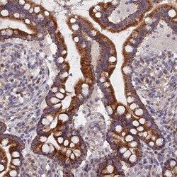 Invitrogen ECSIT Polyclonal Antibody 100 &mu;L; Unconjugated:Antibodies,