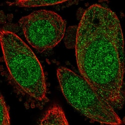C15orf40 Polyclonal Antibody:Antibodies, Polyclonal