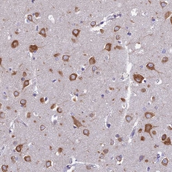 Invitrogen NALP12 Polyclonal Antibody 100 &mu;L; Unconjugated:Antibodies,
