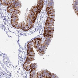 Invitrogen NALP12 Polyclonal Antibody 100 &mu;L; Unconjugated:Antibodies,