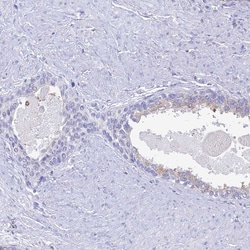 Invitrogen NALP12 Polyclonal Antibody 100 &mu;L; Unconjugated:Antibodies,