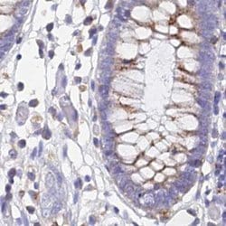 Invitrogen SPNS1 Polyclonal Antibody 100 &mu;L; Unconjugated:Antibodies,