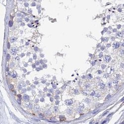 Invitrogen SPNS1 Polyclonal Antibody 100 &mu;L; Unconjugated:Antibodies,