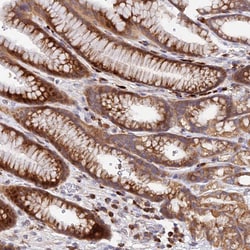 Invitrogen TCP-1 zeta Polyclonal Antibody 100 &mu;L; Unconjugated:Antibodies,