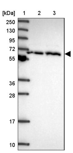 Invitrogen TCP-1 zeta Polyclonal Antibody 100 &mu;L | Buy Online | Invitrogen&trade; | Fisher Scientific