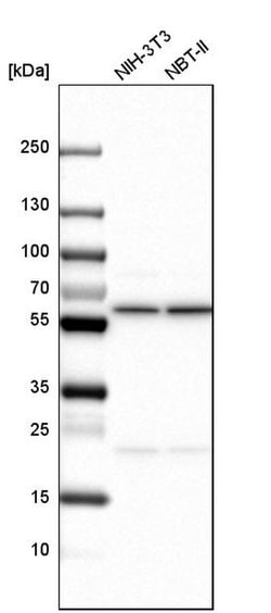 Invitrogen TCP-1 zeta Polyclonal Antibody 100 &mu;L; Unconjugated:Antibodies,