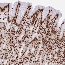 Invitrogen HIST2H2BE Polyclonal Antibody 100 &mu;L; Unconjugated:Antibodies,
